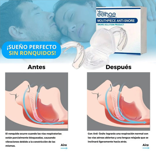 LA SOLUCIÓN CONTRA LOS RONQUIDOS! 💤🚀 PROTECTOR BUCAL ANTI-SNORE AIR FLOW